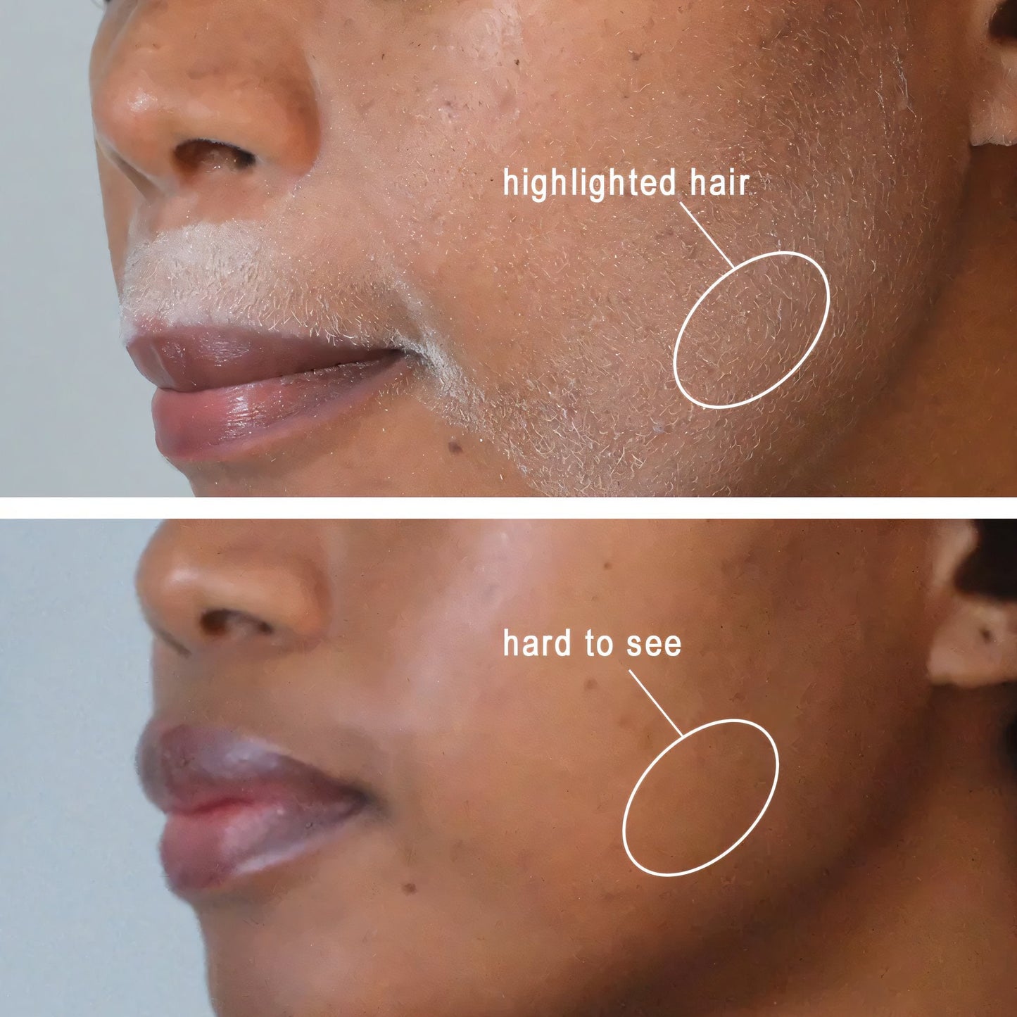 🎁Achetez-en 2 et obtenez-en 1 gratuitement🔥Spray d'identification des cheveux - Rendez votre visage aussi lisse qu'un œuf écalé