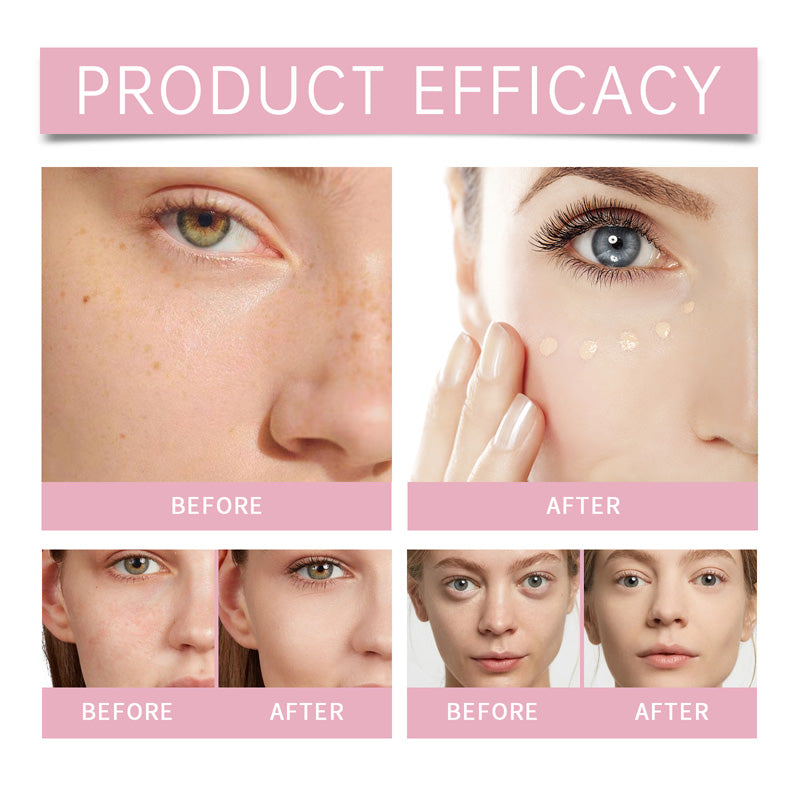 Crème éclaircissante pour le contour des yeux & Crème éclaircissante anti-cernes